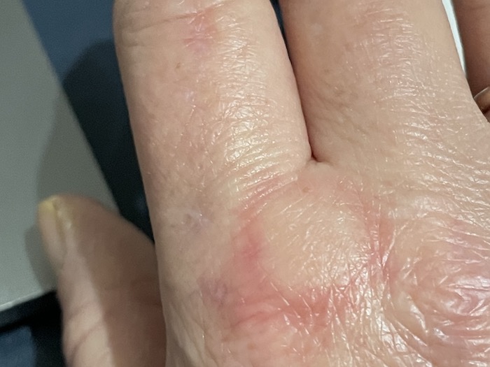 Mosquitoes - "What's going on with Mosquitoes in the UK?", Mosquitoes -“What’s going on with the mosquitoes in the UK?”, Full Body Massage Service