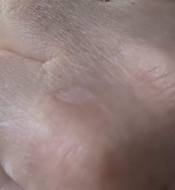 Mosquitoes - "What's going on with Mosquitoes in the UK?", Mosquitoes -“What’s going on with the mosquitoes in the UK?”, Full Body Massage Service