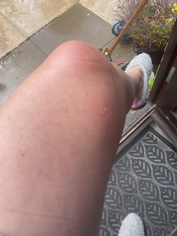 Mosquitoes - "What's going on with Mosquitoes in the UK?", Mosquitoes -“What’s going on with the mosquitoes in the UK?”, Full Body Massage Service